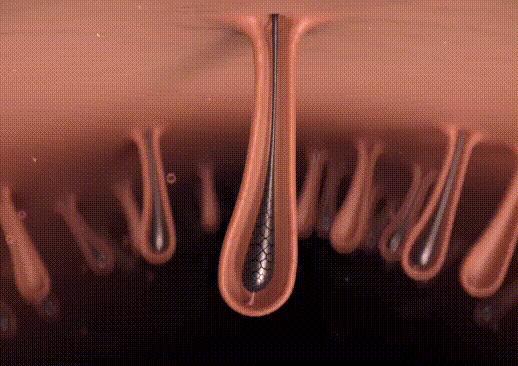 A luz é convertida em calor, desativando o folículo capilar e resultando em um crescimento de cabelo mais fino.